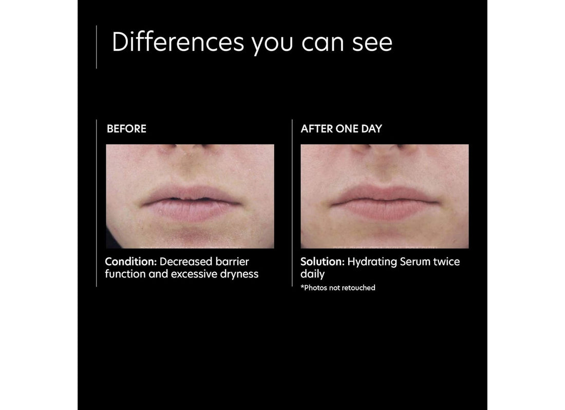 Hydrating Serum